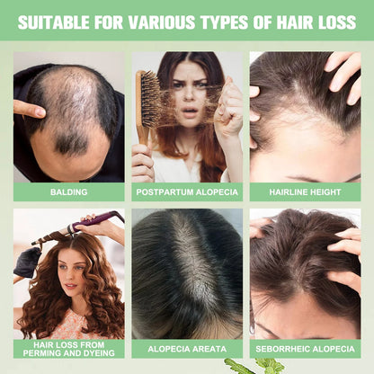 Romarin Anti calvitie repousse des cheveux réparation nourrissante en profondeur