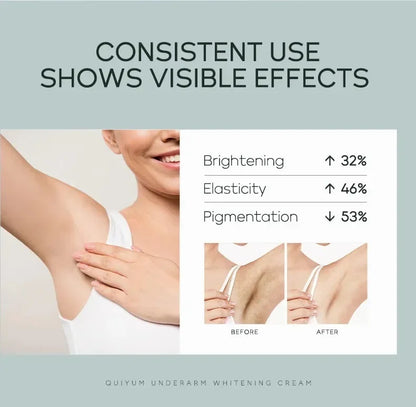 Quiyum aisselles crème pour le corps jambes genou coude crème terne enlever les taches foncées