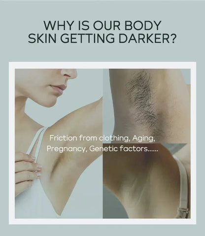 Quiyum aisselles crème pour le corps jambes genou coude crème terne enlever les taches foncées