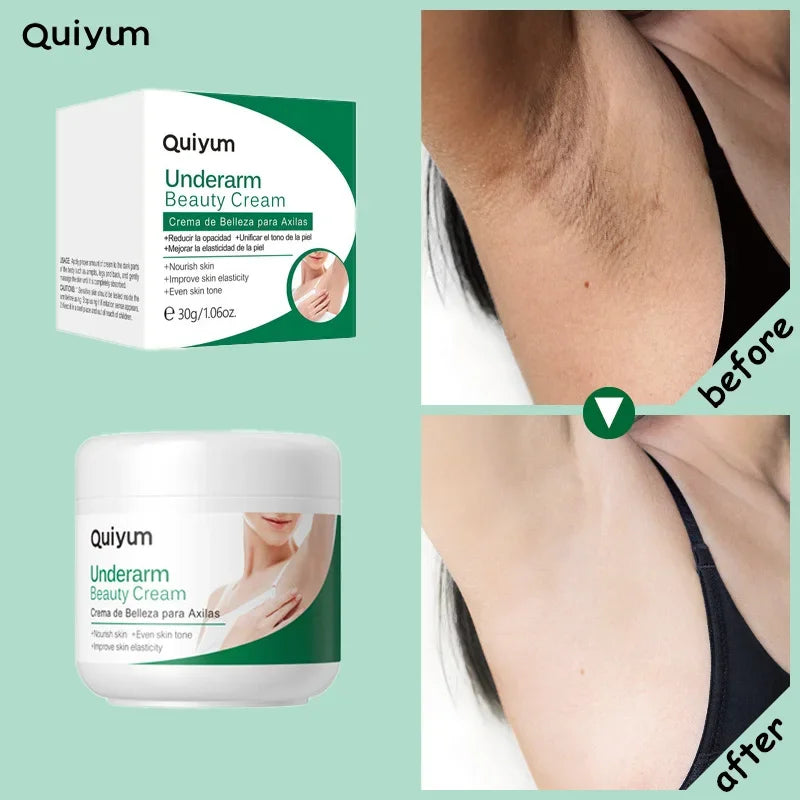 Quiyum aisselles crème pour le corps jambes genou coude crème terne enlever les taches foncées