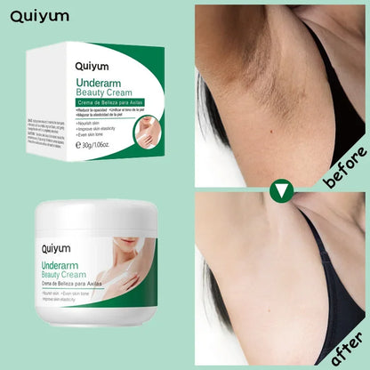 Quiyum aisselles crème pour le corps jambes genou coude crème terne enlever les taches foncées