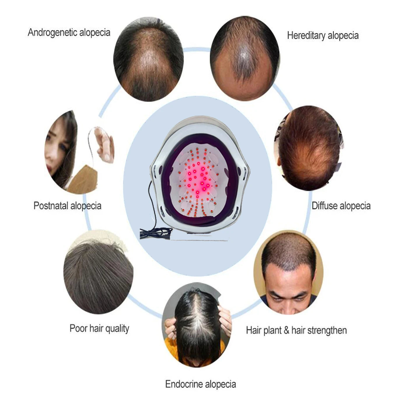 Casque de croissance des cheveux Anti-perte de cheveux Laser chapeau repousse des cheveux dispositif